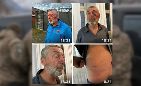 У Сарнах 61-річний майор у відставці потрапив у лікарню: що відомо