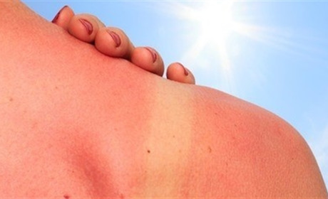 Эффективные методы стереть ущерб от солнца	