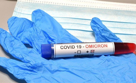 Нежить, втома та головний біль: нові симптоми штаму коронавірусу "Омікрон"