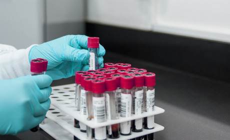 За минулу добу у Сватівському районі +17 хворих на COVID-19 і одна смерть: яка ситуація на Луганщині