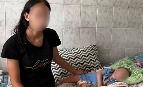 Медики врятували 11-місячного хлопчика з Біляївки, який впав у вигрібну яму