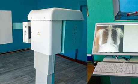 У Кагарлицькій лікарні флюорографію тепер роблять модернізованим апаратом