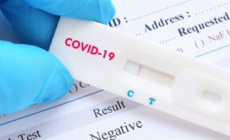 Тестування на COVID-19 може бути безкоштовним: розповідаємо, в яких випадках