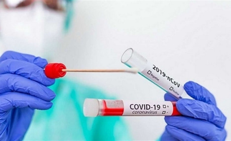 Ковідних хворих по Фастову стало більше у 7 разів