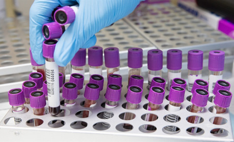 У Луганській області вже 29 лабораторно підтверджених випадків захворювання на COVID-19