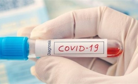 На Чортківщині підтвердили 17 нових випадків COVID-19