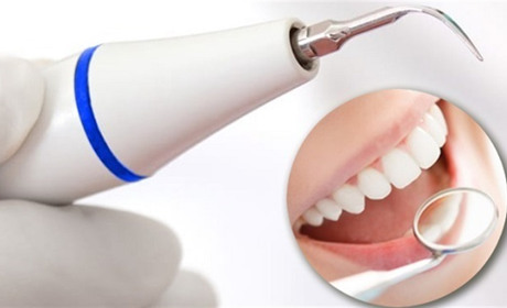 Чи шкодить ультразвукова чистка зубів емалі