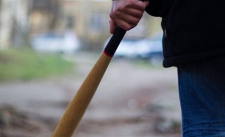 На Переяславщині чоловік побив битою сина своєї колишньої, хлопець у лікарні: хроніка поліції