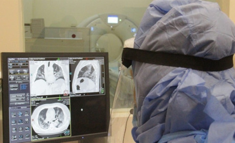 Запитували – відповідаємо: чи необхідно робити комп’ютерну томографію при підозрі на Covid-19?