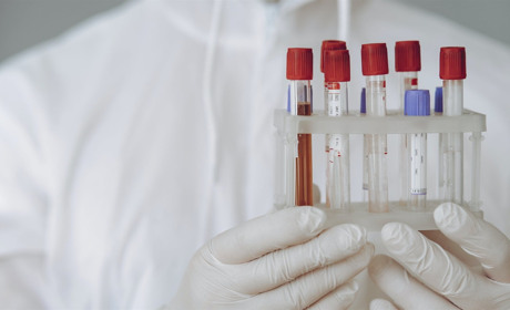 Коронавірус на Сватівщині: за добу у районі у 14 людей підтвердили COVID-19, один хворий помер