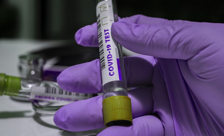 На Луганщині ще у однієї людини підтвердився COVID-19: що про це відомо і яка ситуація на Сватівщині