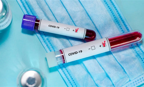 На Золотоніщині кількість хворих на COVID-19 переважає у сільській місцевості