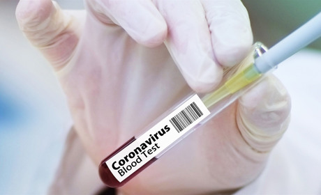 Плюс 206: кількість підтверджених випадків захворювання на COVID-19 в Україні перевищила 1600