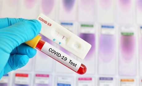 Общее число заболевших COVID-19 в Украине приближается к 30 тысячам: статистика дня в нашем регионе