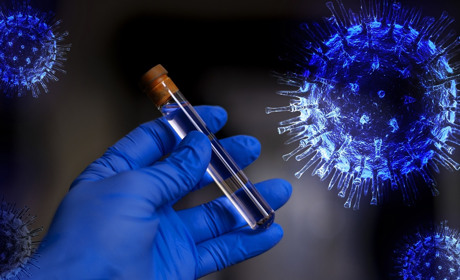 У Луганській області діагноз COVID-19 підтвердився ще у 15 людей