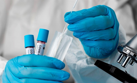 Коронавірус в Мелітополі: які результати останніх досліджень