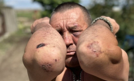 Патрульні побили фронтовика та ображали його дружину: подробиці інциденту на Одещині