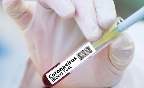 На Сватівщині +53 хворих на COVID-19 за добу, одна людина померла: яка ситуація на Луганщині