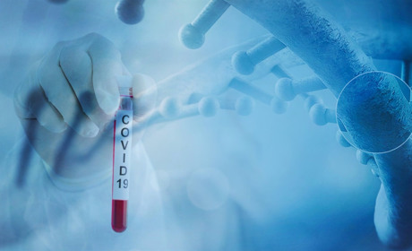 Статистика по коронавірусу на 30 липня: у Вараші – 212 хворих, на Володимиреччині – 140