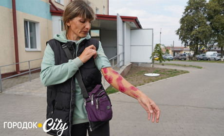 У Городку безпритульні собаки покусали жінку. Влада прокоментувала ситуацію
