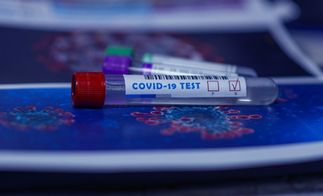Ще два випадки COVID-19 на Сарненщині: звідки поступили нові пацієнти