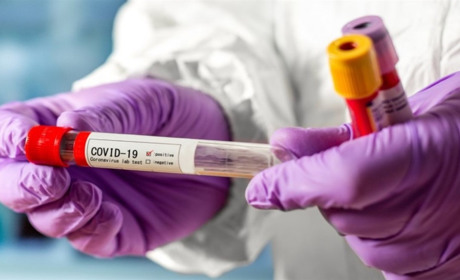 ПЦР тест на Covid-19: преимущества и недостатки