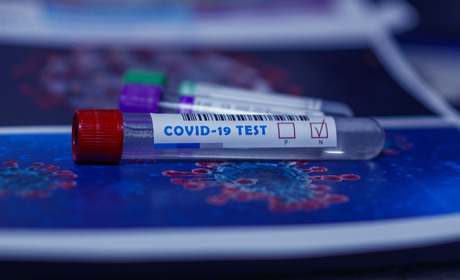 У Луганській області за добу COVID-19 підтвердився у ще однієї людини