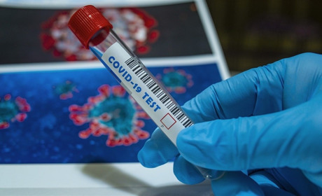 У Сватовому ще одна людина захворіла на COVID-19: це другий випадок інфікування у районі