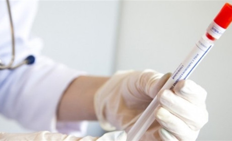 В Україні +7866 хворих на COVID-19: що з поширенням у Сватівському районі і Луганській області