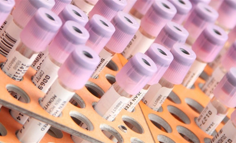 На Луганщині проводять епідрозслідування по 103 підозрам на COVID-19. Що у Сватівському районі