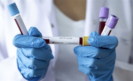 В яких населених пунктах і громадах зареєстровані хворі на COVID-19 станом на 30 листопада