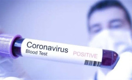 Білопілля. Плюс один випадок COVID-19