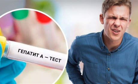 В мешканця Жовтих Вод підозрють гепатит А: симптоми та профілактика цього захворювання