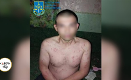 Херсонець жорстоко розправився зі своєю знайомою, жінка померла у лікарні