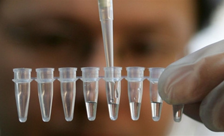 В Україні два антирекорди — за кількістю захворілих та за кількістю померлих