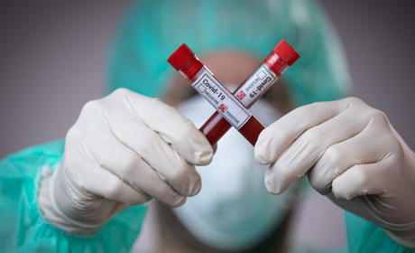 В Запорожской области за сутки 19 новых случаев коронавируса, а сколько из них в Мелитополе?