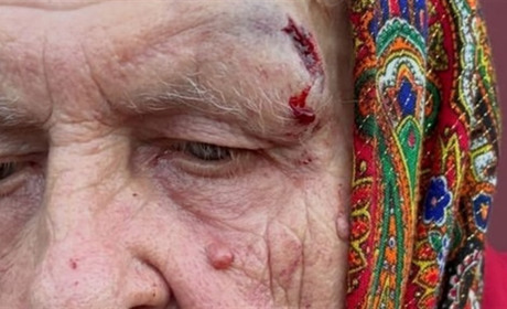 Домашнє насильство на Берестинщині: у справі — подружжя педагогів, родичі вимагають справедливості