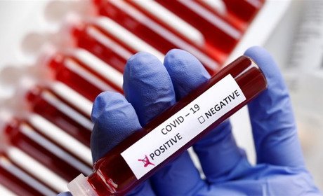 У Сватівському районі за добу +33 хворих на COVID-19, в Україні — 4640: яка ситуація на Луганщині