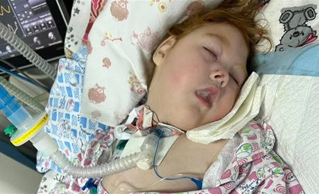 Життя дворічної Софійки з Чортківщини залежить від двох портативних апаратів ШВЛ