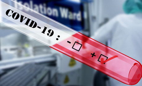 На Луганщині за минулу добу у трьох людей підтвердили COVID-19, двох раніше хворих госпіталізували