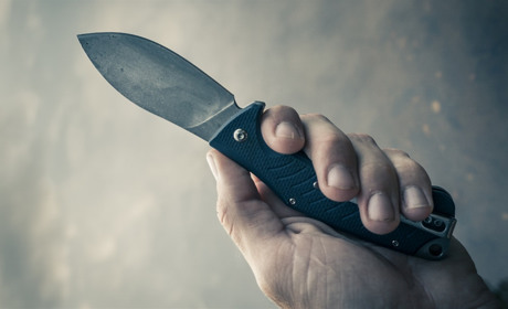 Напав невідомий: у Сарнах жінці порізали обличчя