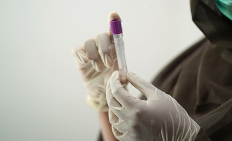 Результати тестів в Мелітополь надходять із запізненням майже на тиждень