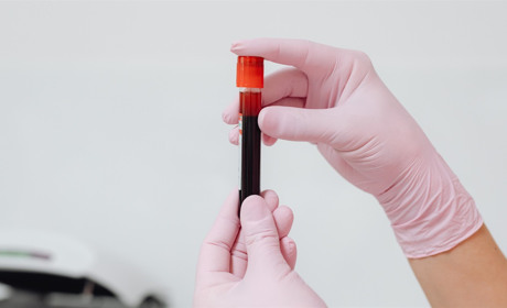 Від донації до переливання: коли і як можна здати кров у Сарнах