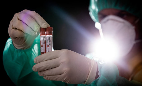 На Білопільщині четверо хворих на COVID-19 - на самоізоляції