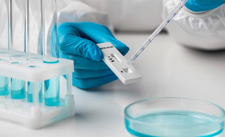 В Україні за добу +23785 хворих на COVID-19, 614 померли: яка ситуація на Сватівщині і Луганщині