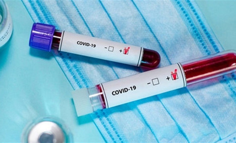 Які показники COVID-19 на Золотоніщині станом на середину весни