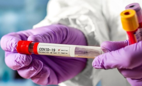 В Україні за добу COVID-19 підтвердили у 5744 людей: яка ситуація у Сватівському районі