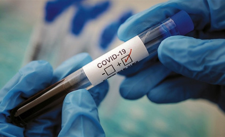 Маска, дезінфектор, відстань в півтора метри: на Мелітопольщіні підтверджено новий випадок COVID-19