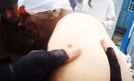 Поліцейські офіцери громади евакуювали поранених від обстрілів у Ворожбі