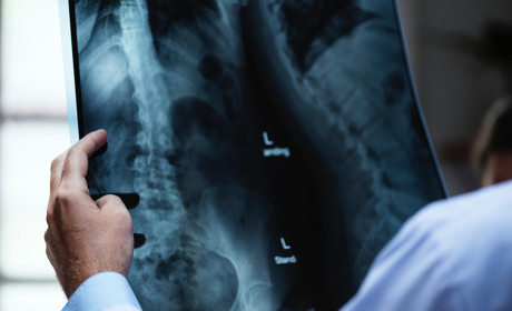 Медреформа: більше 10 тисяч сватівчан не підписали декларацію, бо не вистачає лікарів